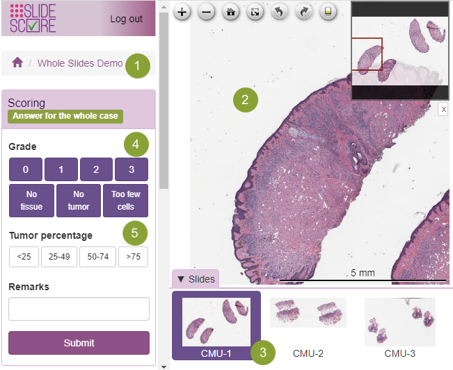 whole slide viewer whole slide viewer